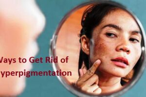 Here Are Ways to Get Rid of Hyperpigmentation