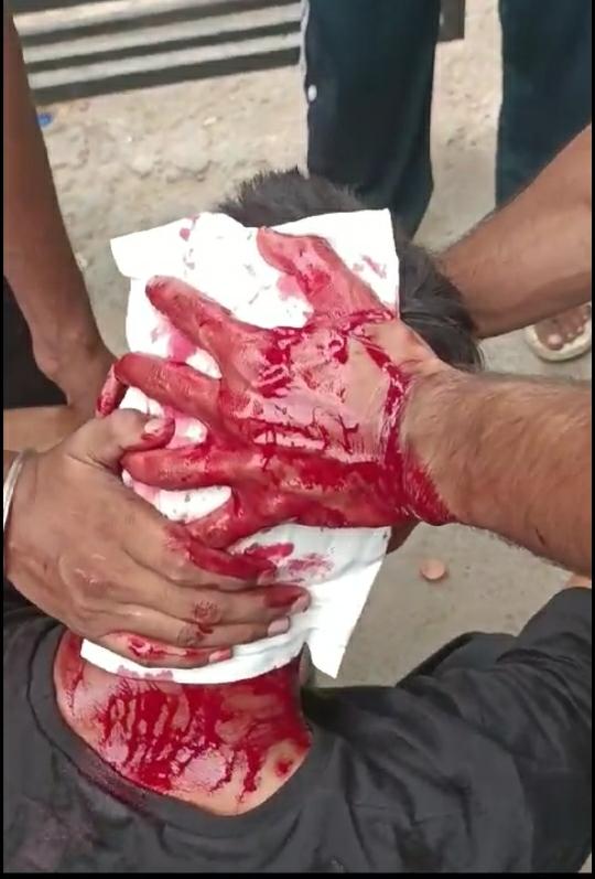 Kashmiri students brutally beaten in Punjab; JKSA takes matter with authorities